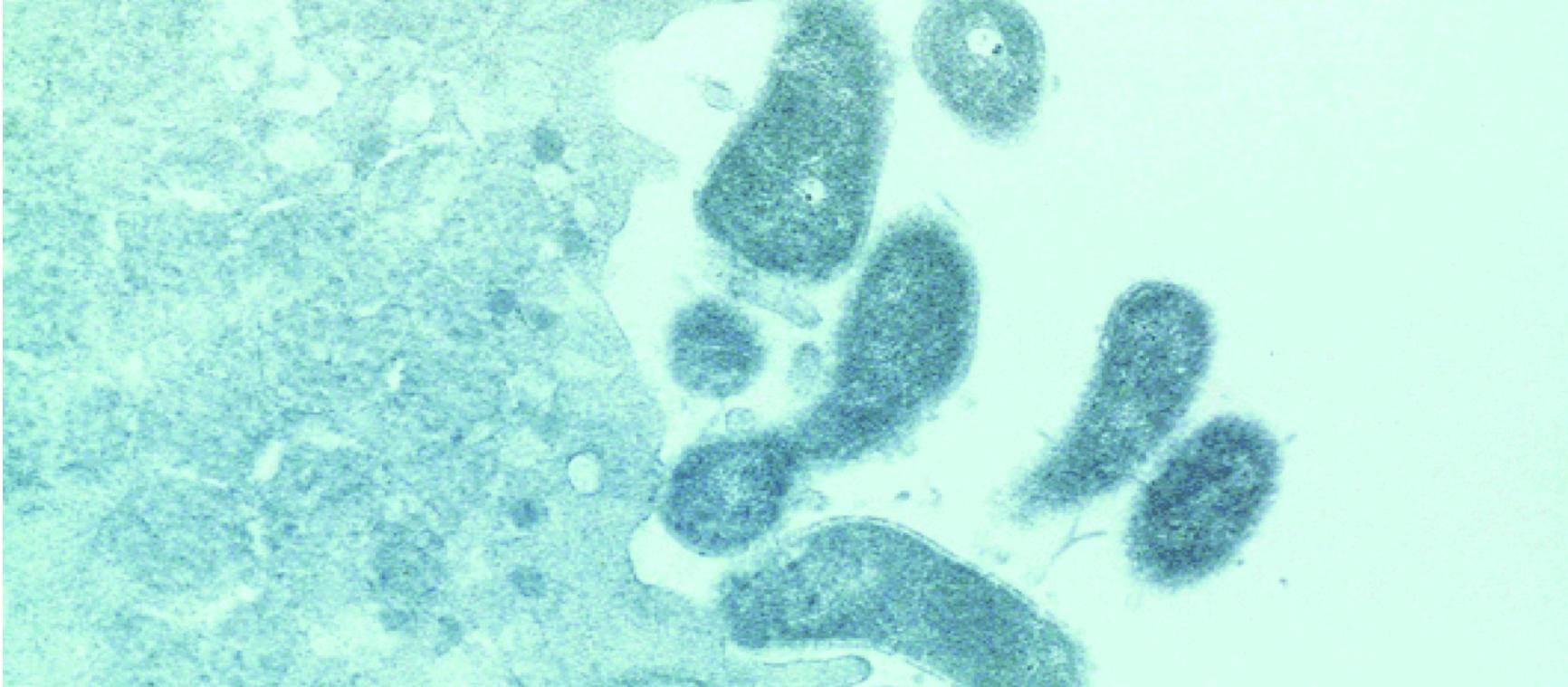 Electron microscopy image of H. pylori organisms