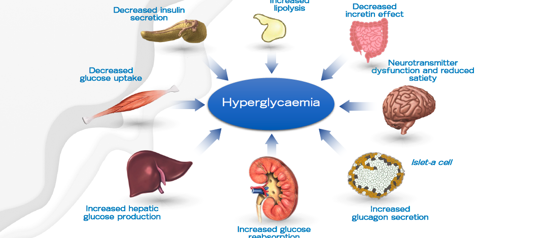 Webinar 1 Hyperglycaemia