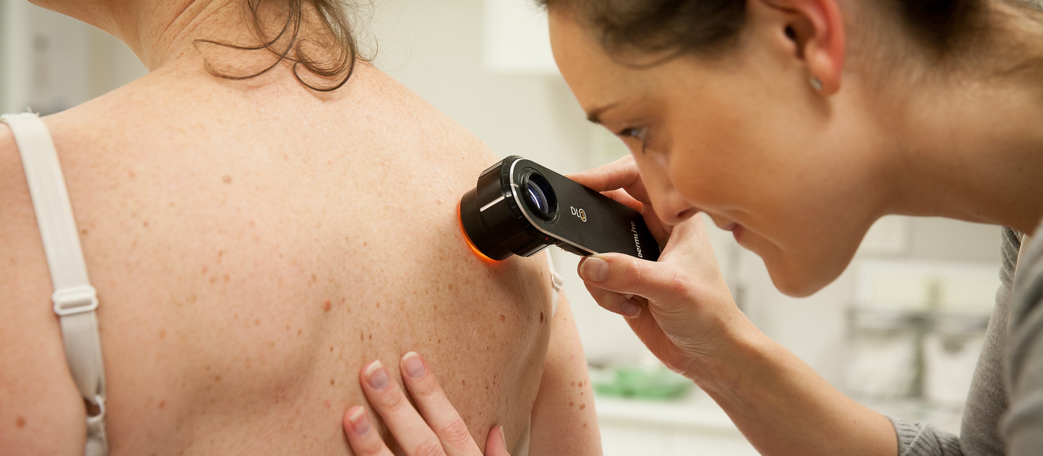 Skin check with dermatoscope