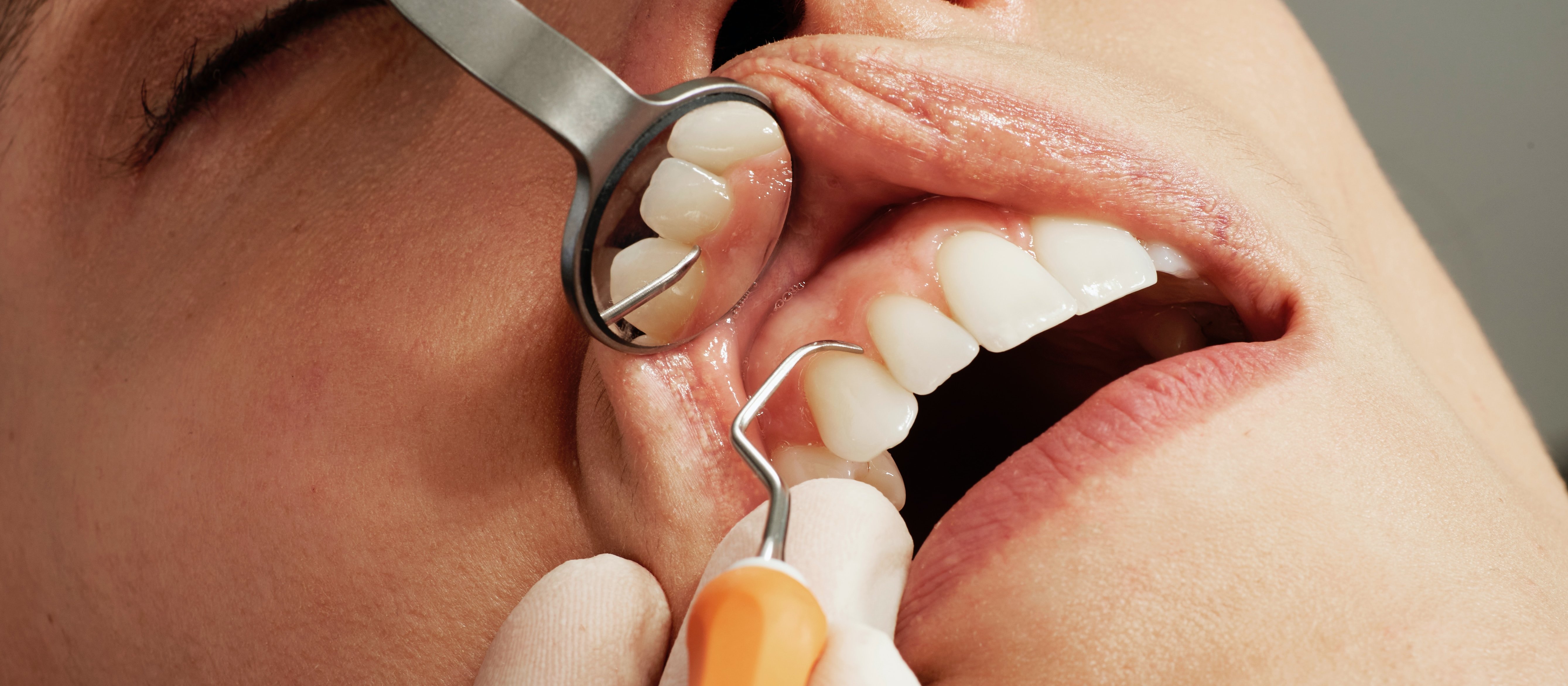 Person receiving dental care