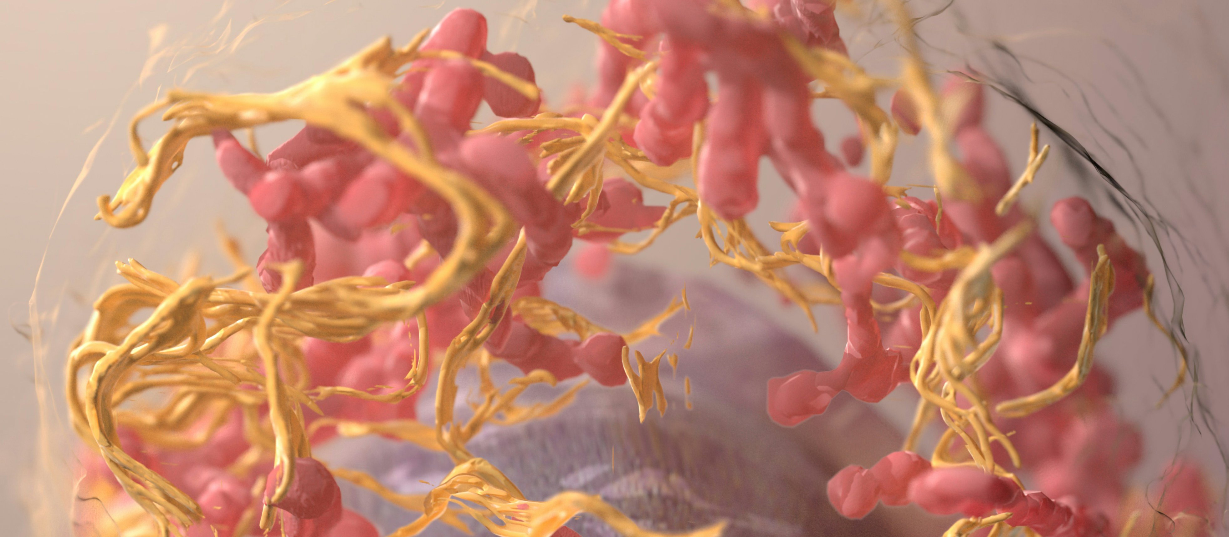 3D structure of a melanoma cell