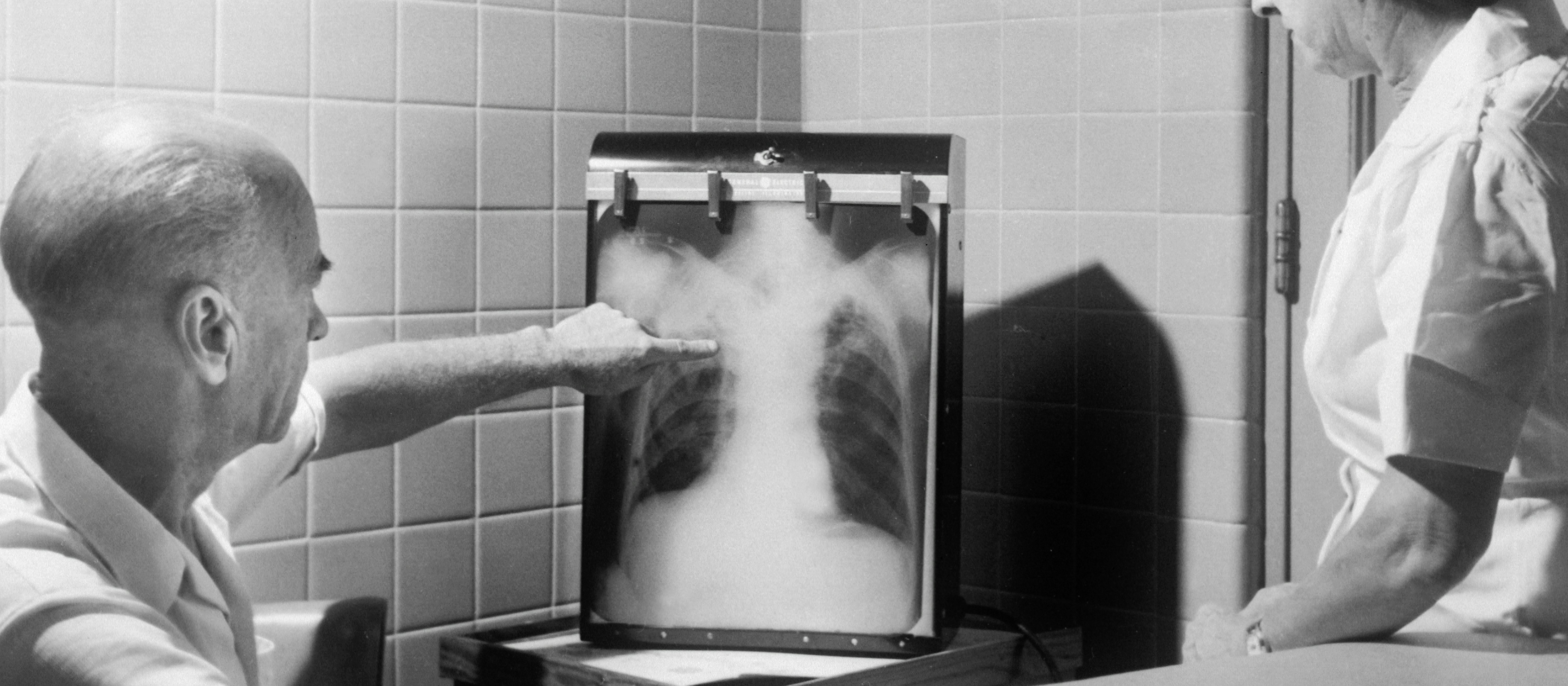 Black and white photo of a doctor and nurse looking at a chest x-ray