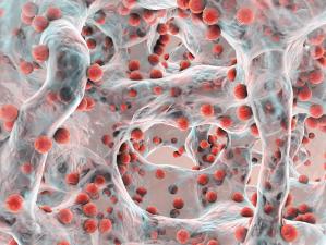 Biofilm of antibiotic resistant bacteria