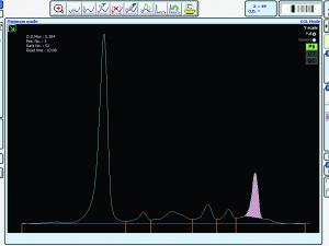 Electrophoretogram