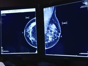 Breast scan