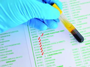 Liver function tests