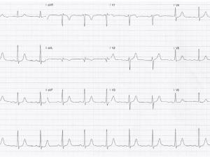 ECG - issue 06 May