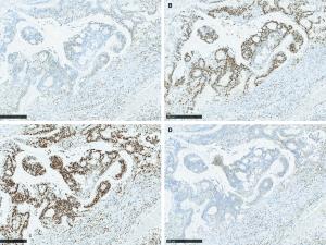 Genetic medicine, immunohistochemical 