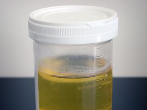 Urine test