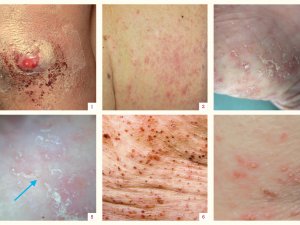 Dermatology July 21