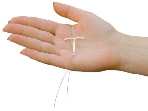 Mirena IUD