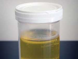 Urine sample