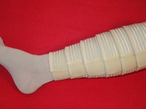 Compression bandage 