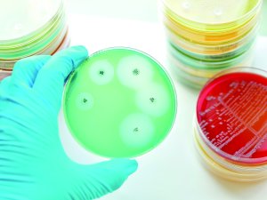 petri dish jarun011 on Adobe Stock