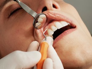 Person receiving dental care