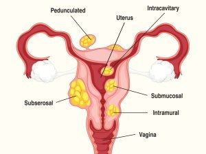 Uterus