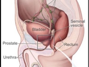 Bladder diagram