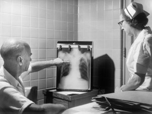 Black and white photo of a doctor and nurse looking at a chest x-ray