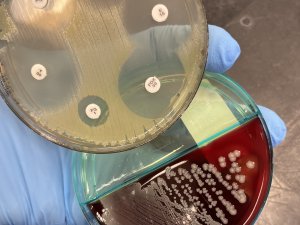 Agar plates