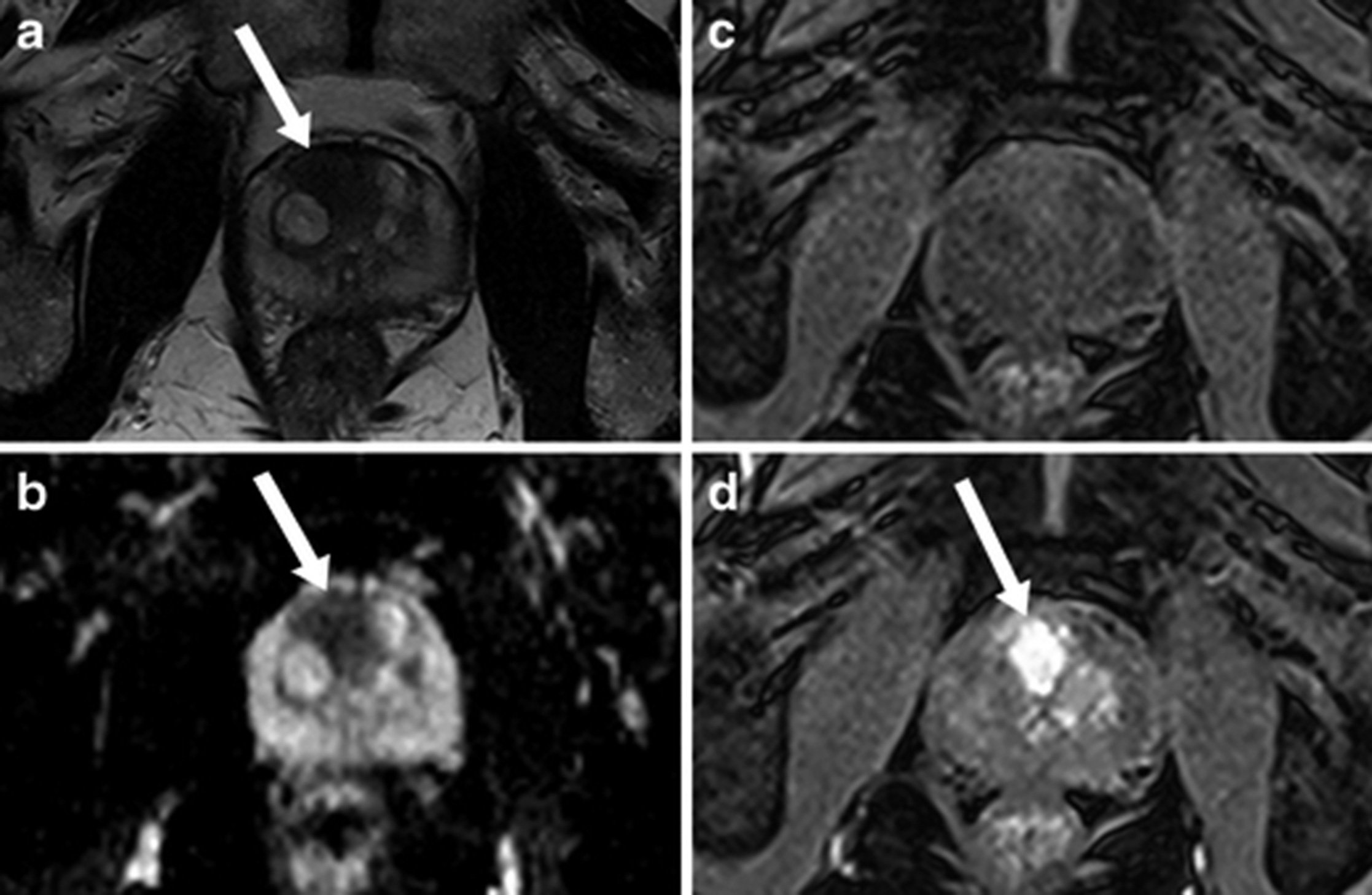 Figure-2.-Image_MRI